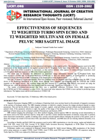 Image of EFFECTIVENESS OF SEQUENCES T2 WEIGHTED TURBO SPIN ECHO AND T2 WEIGHTED MULTIVANE ON FEMALE PELVIC MRI SAGITTAL IMAGE